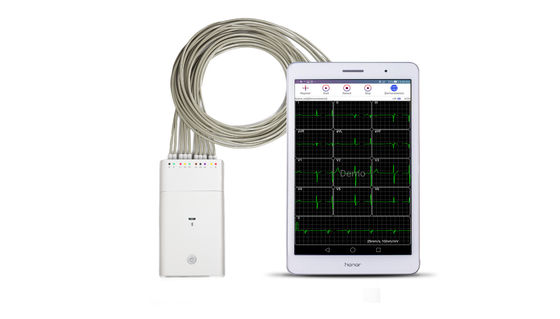 Белая машина системы Bluetooth ECG Andriod рекордера сигнала ECG